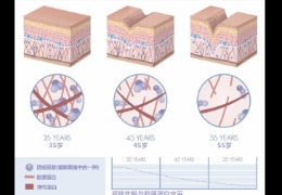 都在問的乙酰殼糖胺（NAG）功效怎么樣？功效成分的護膚品應該怎么選？