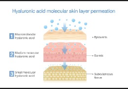 如何選擇適合油痘肌的精華產(chǎn)品？
